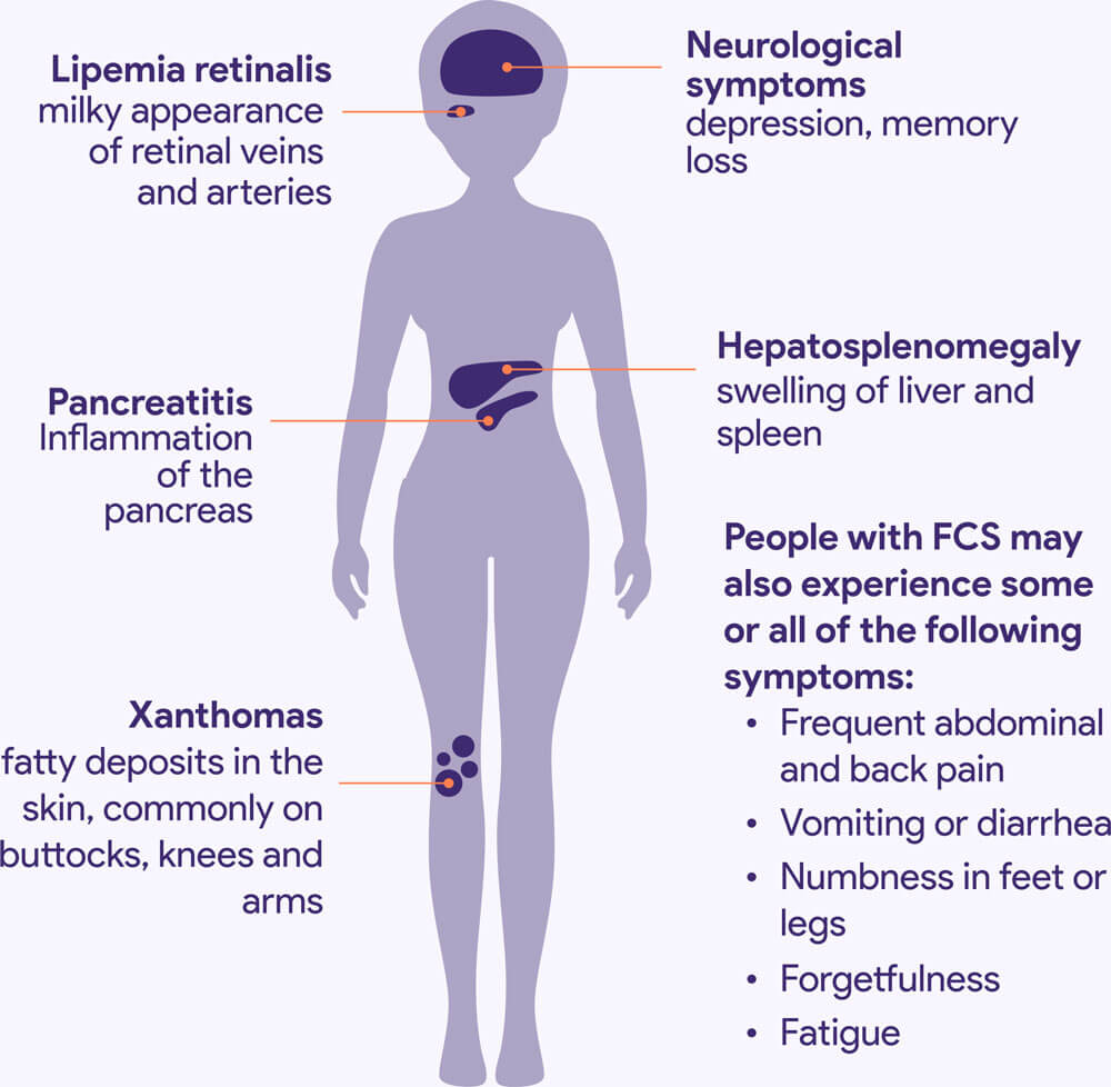 Signs and Symptoms of FCS Signs and Symptoms of FCS